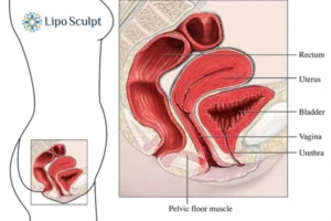 Treatment For A Leaky Bladder 2 How EM Chair treatment Northwood can help Leaky bladder issues. Read more now!