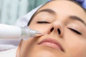 Best Actinic Keratoses Removal 3 Actinic keratoses Northwood solutions - book in today!