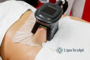 Does Fat Freezing At Home Work? 3 Fat freezing at home from Lipo Sculpt Northwood